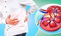 ضرورت مراقبت از کلیه ها در تابستان هنگام فعالیت پیاده روی