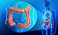 اجرای برنامه غربالگری و تشخیص زود هنگام سرطان روده بزرگ در تمامی مراکز خدمات جامع سلامت 