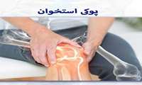 برای سلامتی استخوان خود قدم برداریم